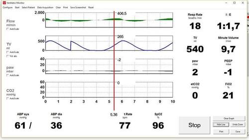 Ventilation Monitor