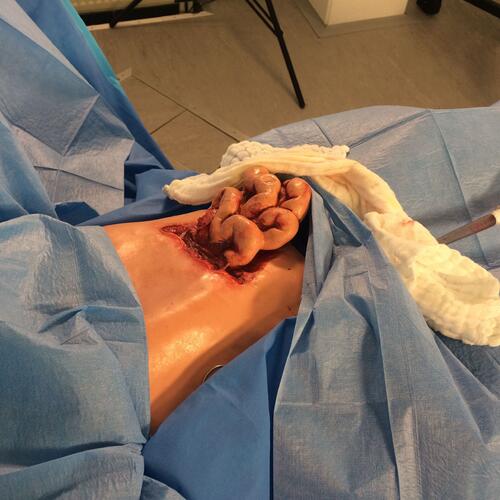 Zwischenfallmanagement